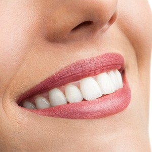 Close-up of smile after teeth whitening in Lincoln, NE