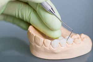 closeup of a dental bridge on clay model