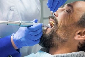 man getting a dental cleaning 