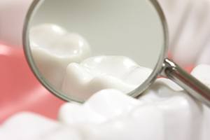 Closeup of teeth with dental sealants