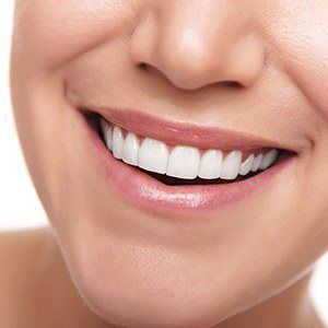 Closeup of white smile after teeth whitening