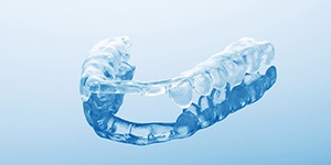 mouthguard for protecting implants