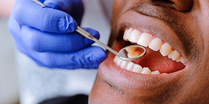 man getting a dental checkup