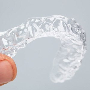 A single clear Invisalign aligner tray