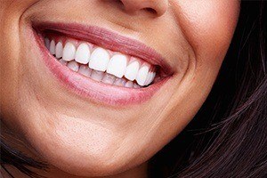 Closeup of bright white smile after teeth whitening