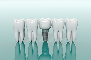 Model teeth next to a single tooth dental implant in Lincoln for comparison