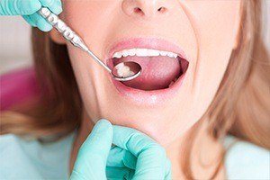 Closeup of smile during dental exam after tooth-colored filling placement