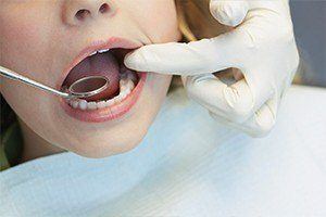 Closeup of smile during dental checkup after tooth colored filling treatment