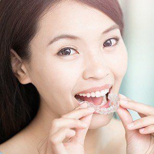 Woman placing Invisalign tray