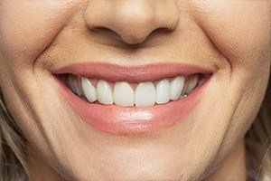 Closeup of healthy smile after gum disease treatment