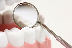 Closeup of teeth during dental checkup