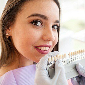 Smile compared with tooth shading chart during cosmetic dentistry treatment