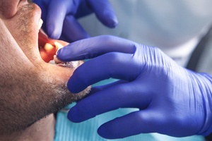 A dentist using their hands to conduct a physical, oral examination on a patient to ensure there are no signs of oral cancer