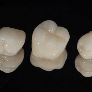 Three options for porcelain dental crowns