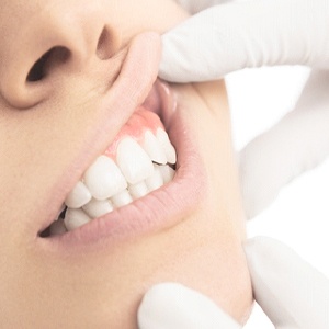 Teeth gums examined prior to scaling treatment