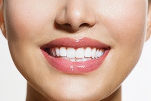A closeup of a women smiling after tooth colored filling restoration