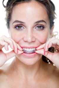 Your Invisalign provider in Lincoln helps you improve your smile.