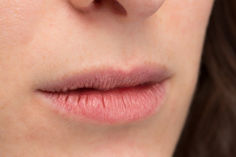 an up-close look at a person’s chapped lips