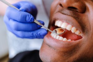 patient getting a dental checkup