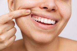 woman looking at her gums checking for irritation