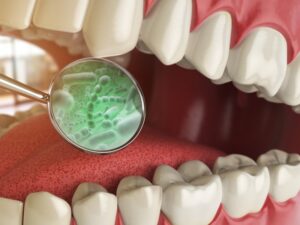 diagram of bacteria in a mouth