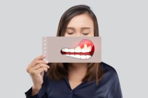 woman holding an illustration of a smile with gum disease
